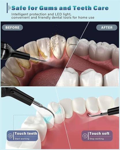 Plaque Remover for Teeth, Dental Cleaning Kit Tartar Remover for Teeth - Image 2
